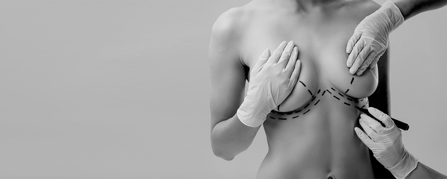 Lifting des seins et prothèses mammaires à Bordeaux