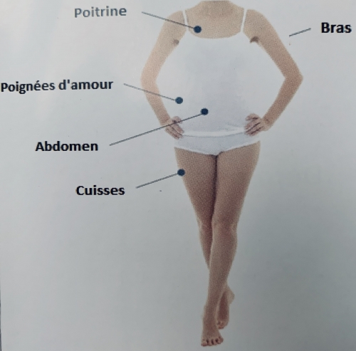 HIFU pour le corps
