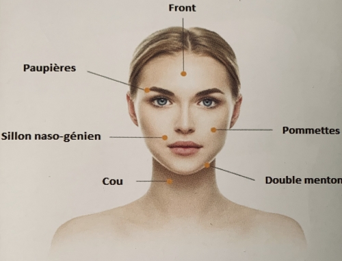 HIFU pour le visage